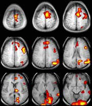 brain scans